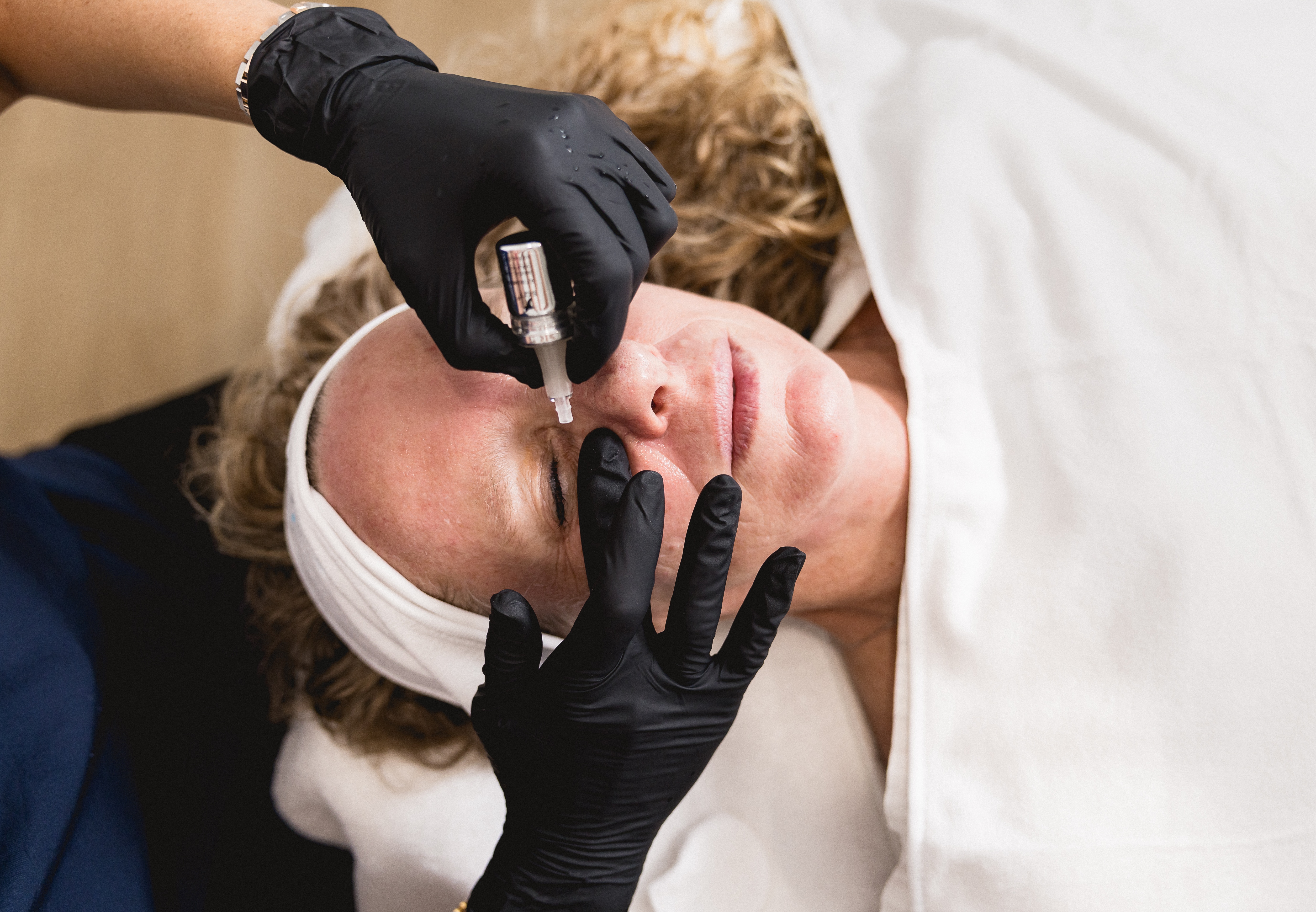 SQT Biomicroneedling Treatment